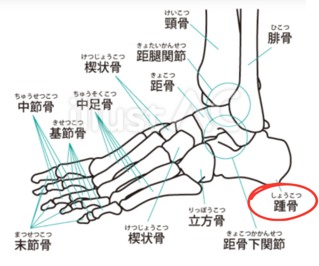 外反母趾