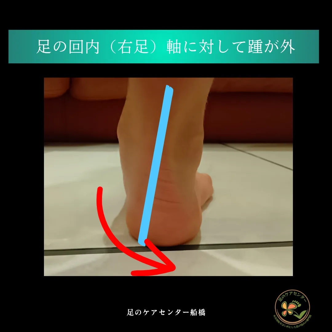 回内