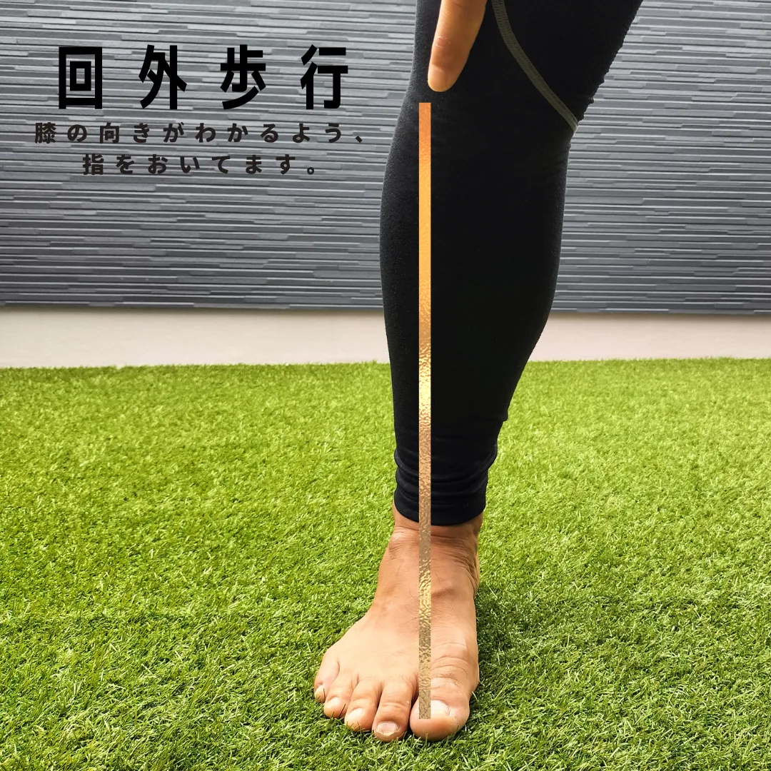 外反母趾