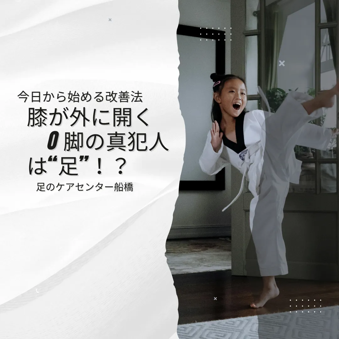 外反母趾
