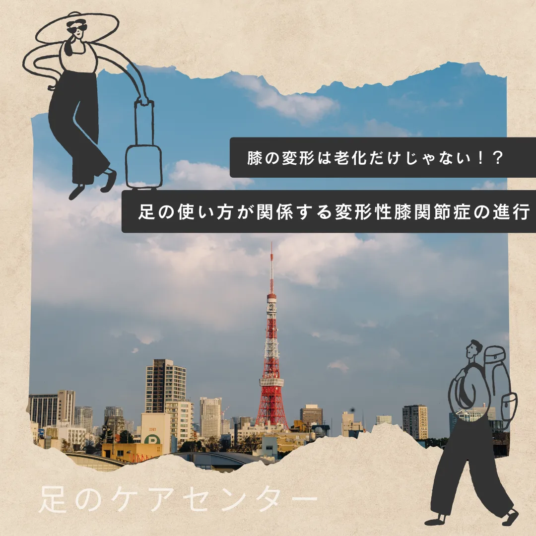 膝の変形は老化だけじゃない！？足の使い方が関係する変形性膝関節症の進行