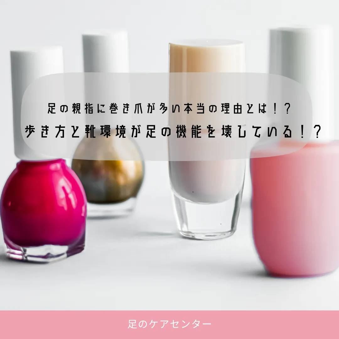 足の親指に巻き爪が多い本当の理由とは～歩き方と靴環境が足の機能を壊している！？