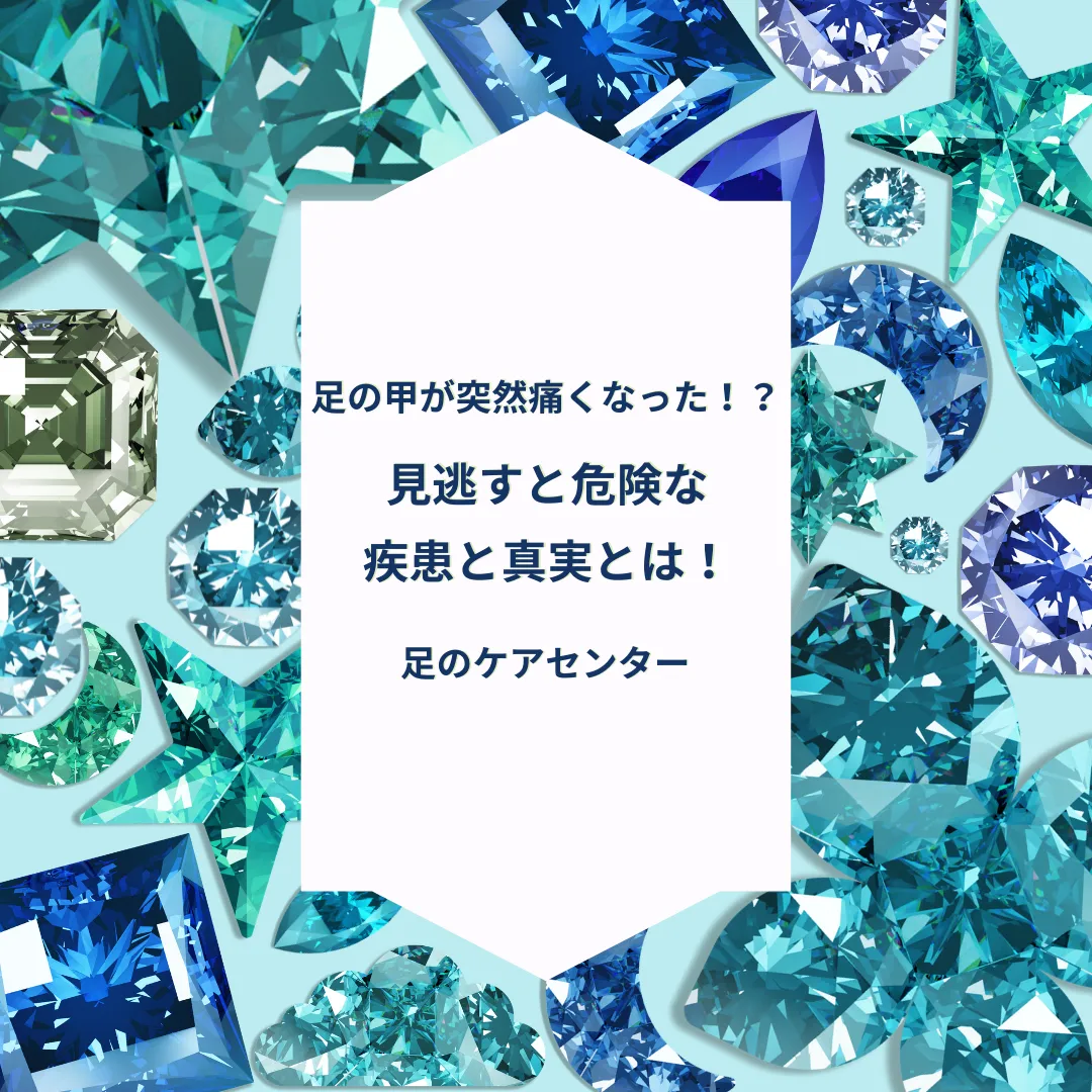 足の甲が突然痛くなった!?見逃すと危険な疾患と真実とは!