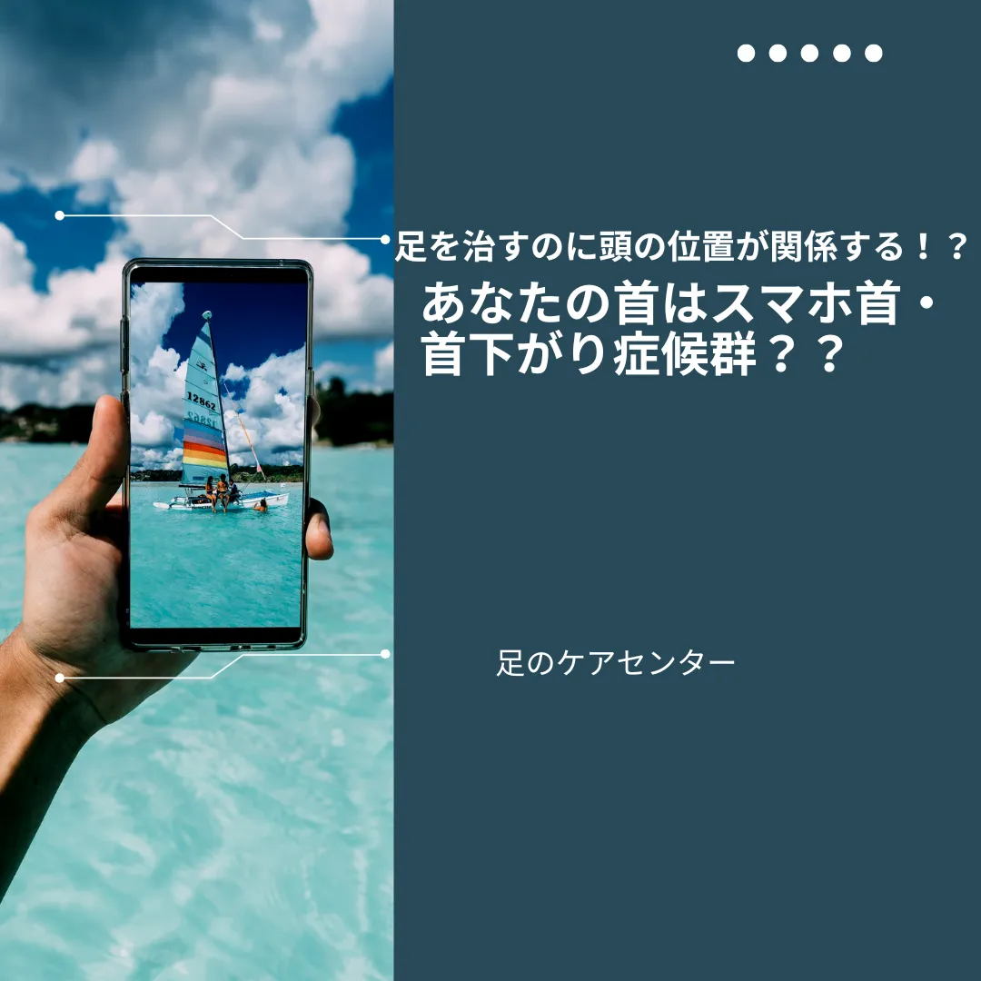 足を治すのに頭の位置が関係する!?あなたの首はスマホ首・首下がり症候群??