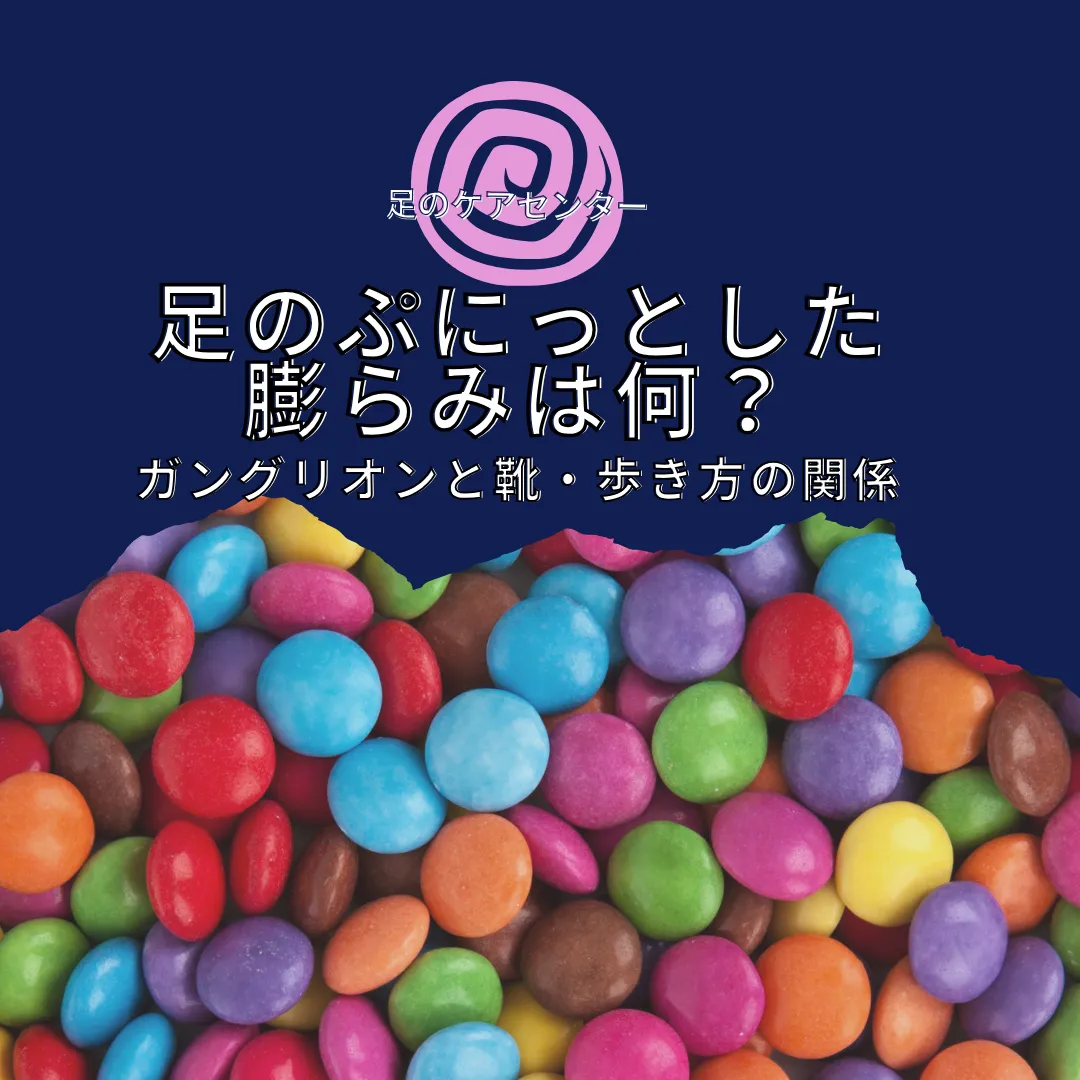 足のぷにっとした膨らみは何?ガングリオンと靴・歩き方の関係