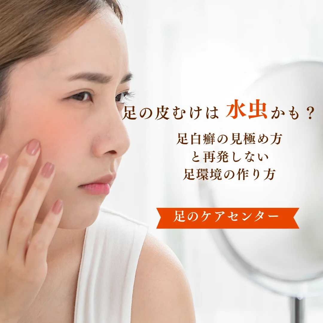足の皮むけは水虫かも？足白癬の見極め方と再発しない足環境の作り方