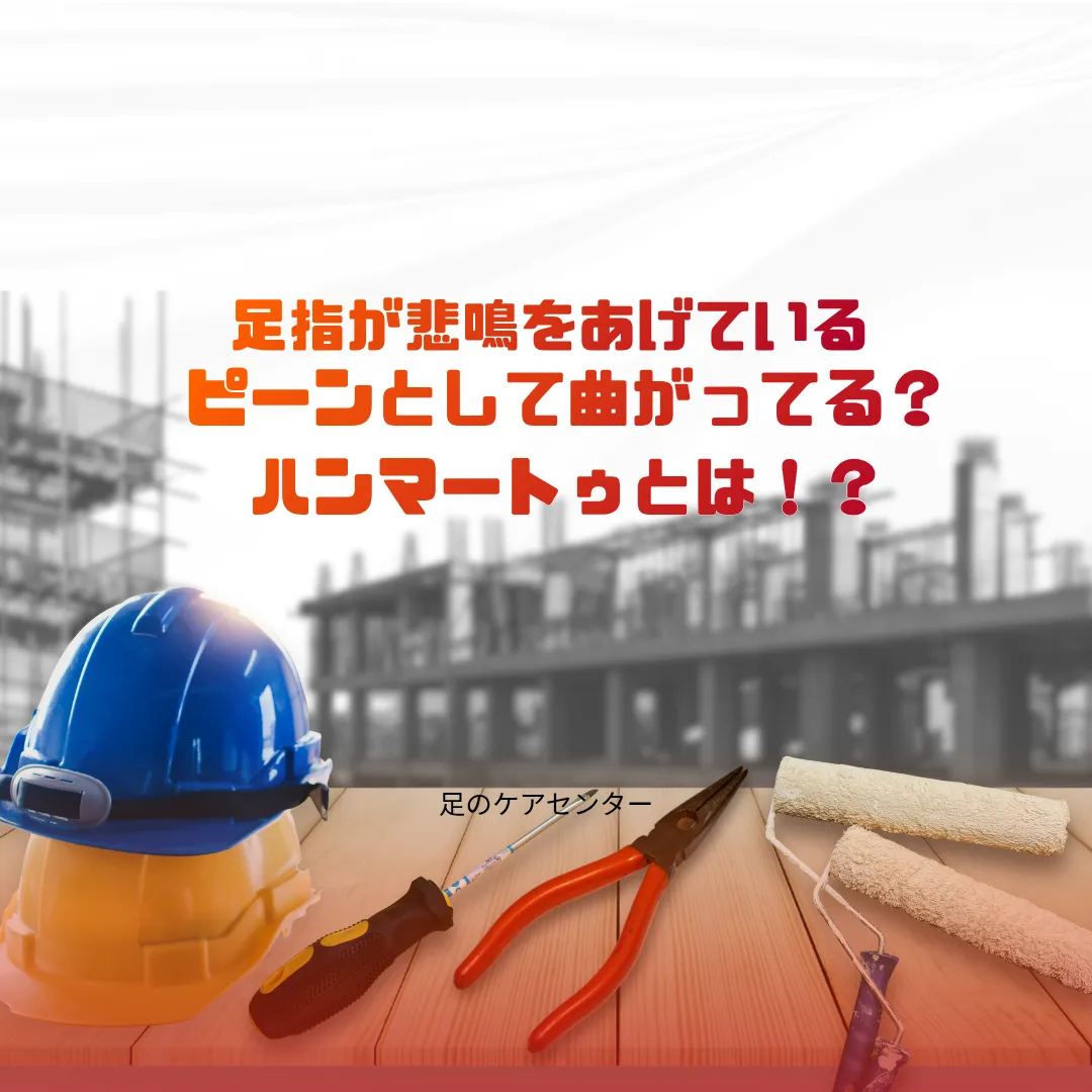 足指が悲鳴をあげている～ピーンとして曲がってる？ハンマートゥとは！？