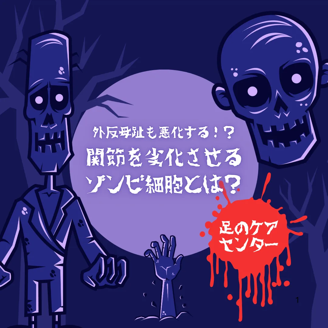 外反母趾も悪化する！？関節を劣化させるゾンビ細胞とは？